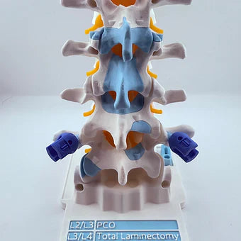 Upgrade Your Medical Training with Premium Spine Demonstration Models