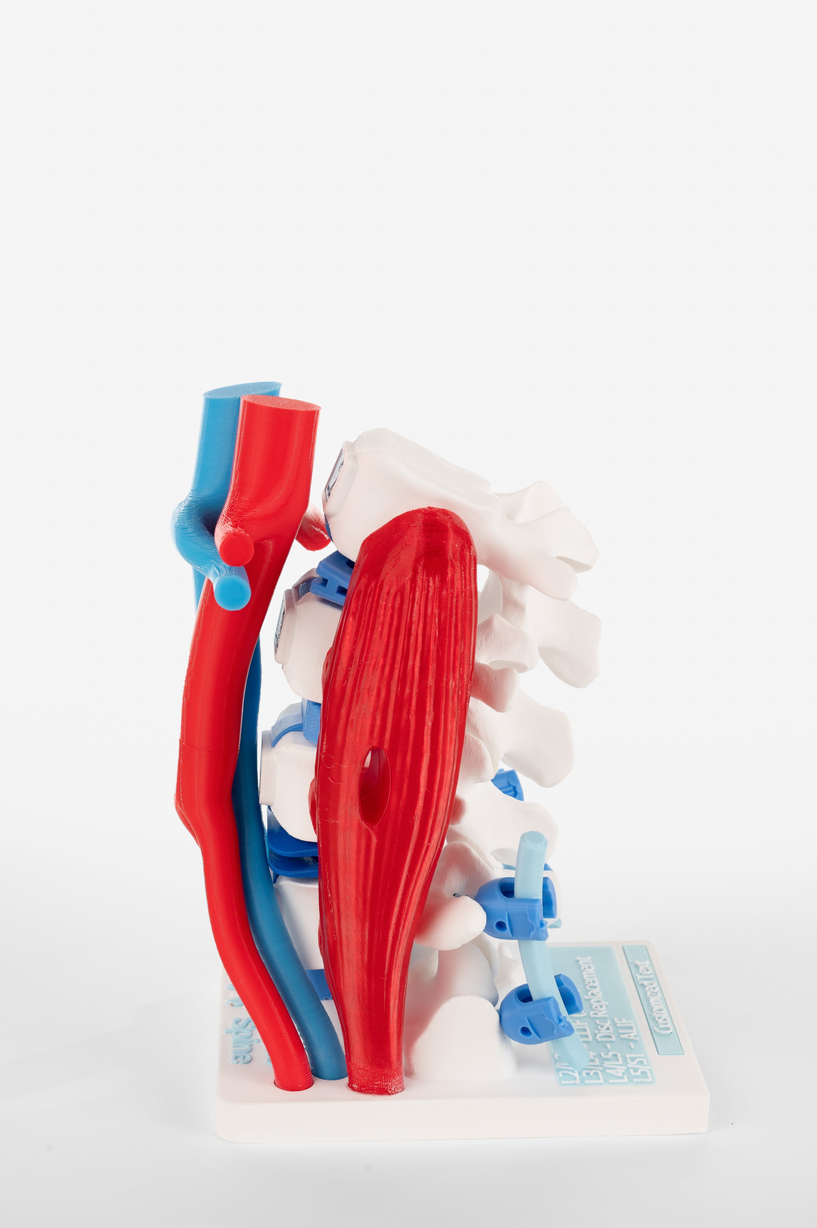 Empowering Medical Professionals with Accurate Spine Education Models