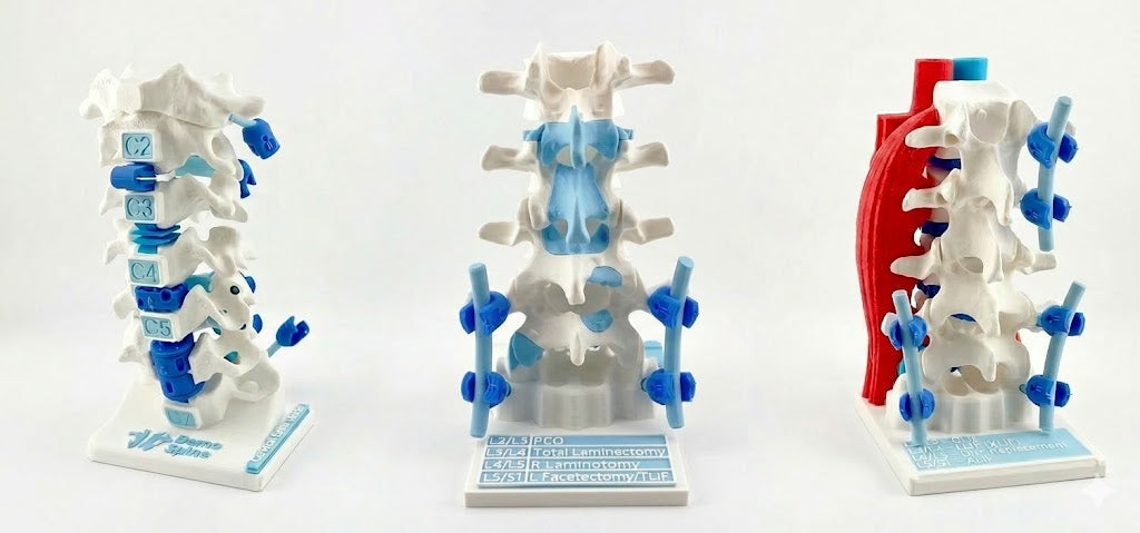 Discover Premium 3D Spine Anatomy Models Designed by Surgeons