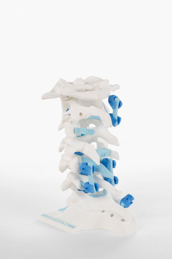 Pedicle Screw & Rod System