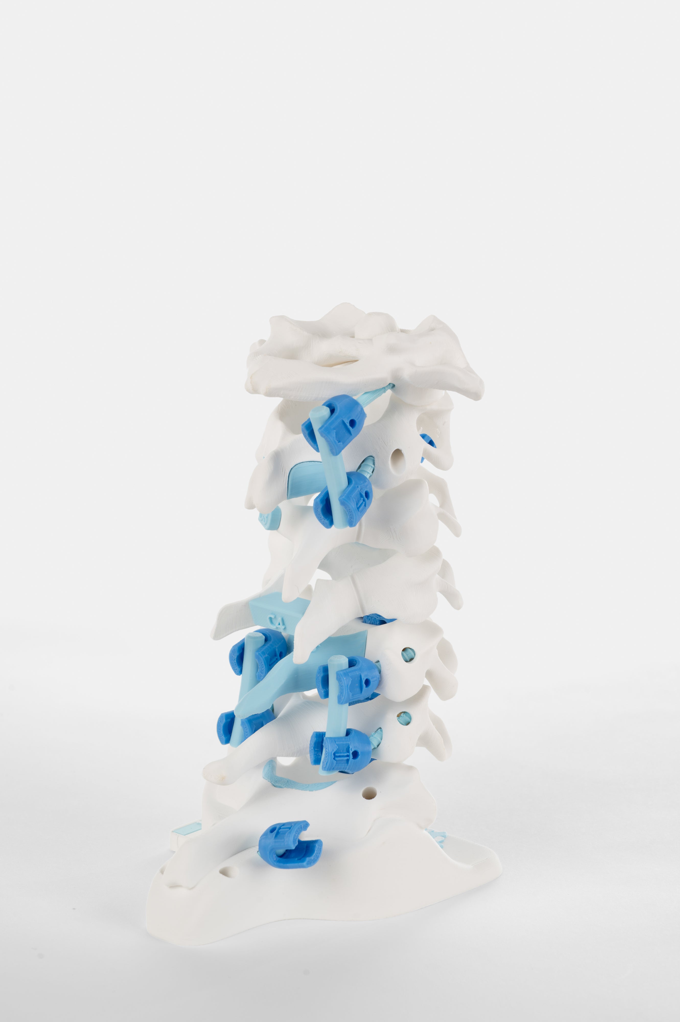 Cervical Surgery Model