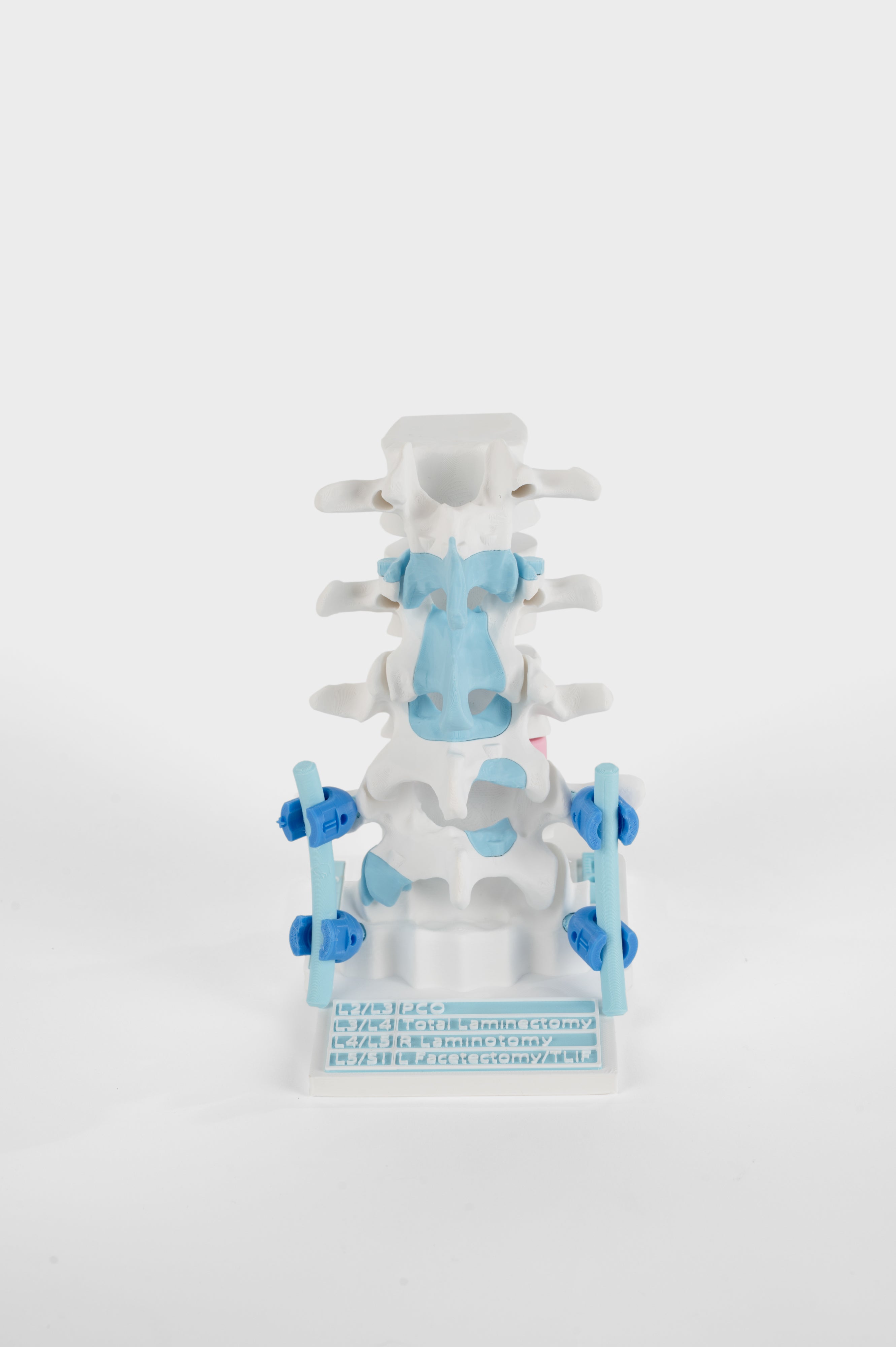 Posterior Lumbar Surgery Model – Demospine