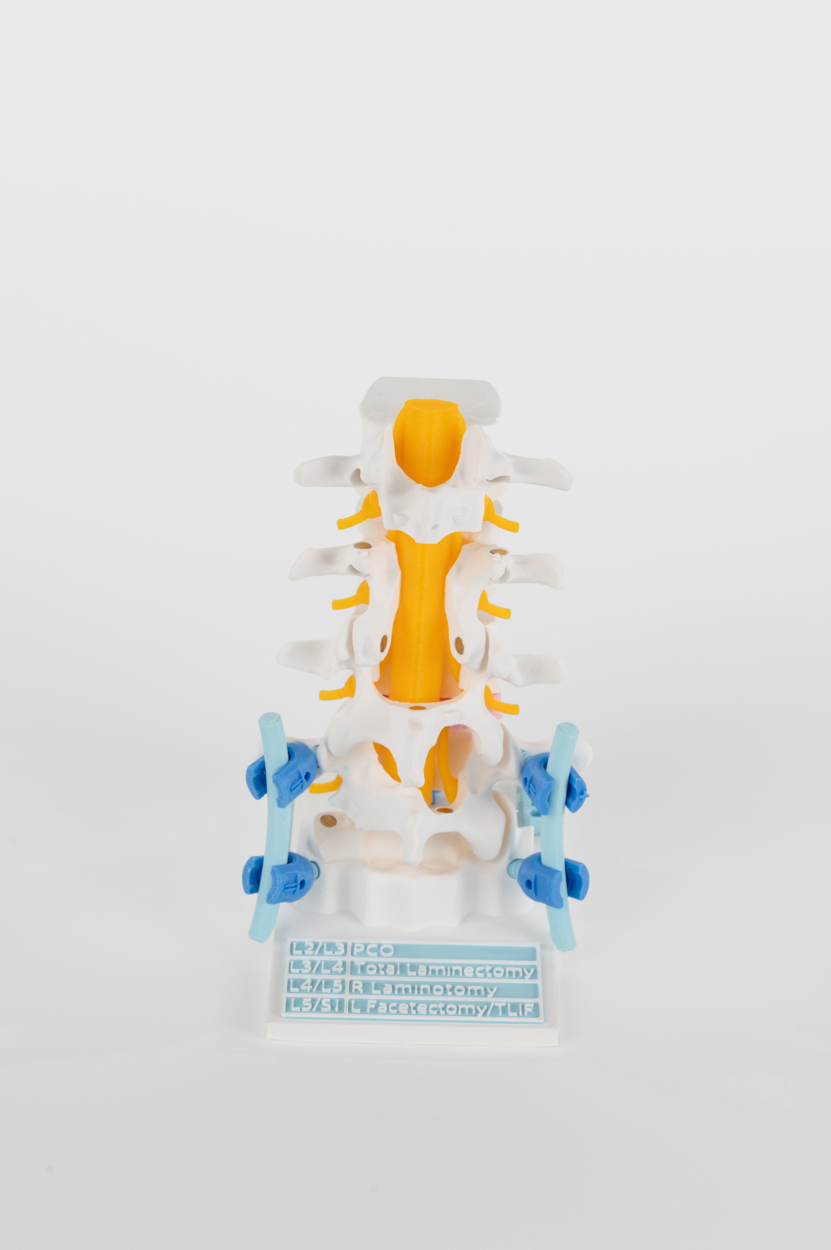 Spinal Cord – Demospine