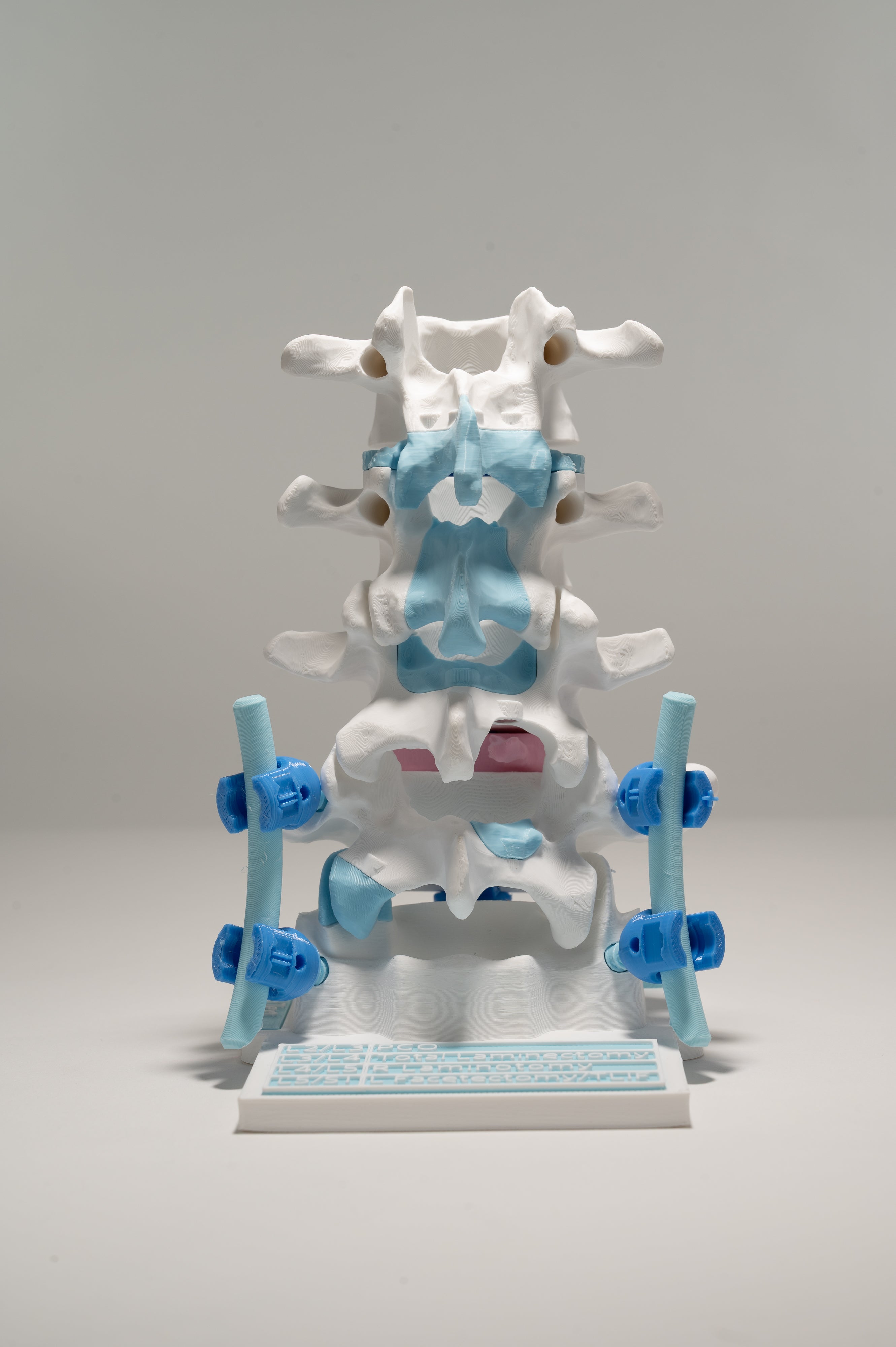 Posterior Lumbar Surgery Model