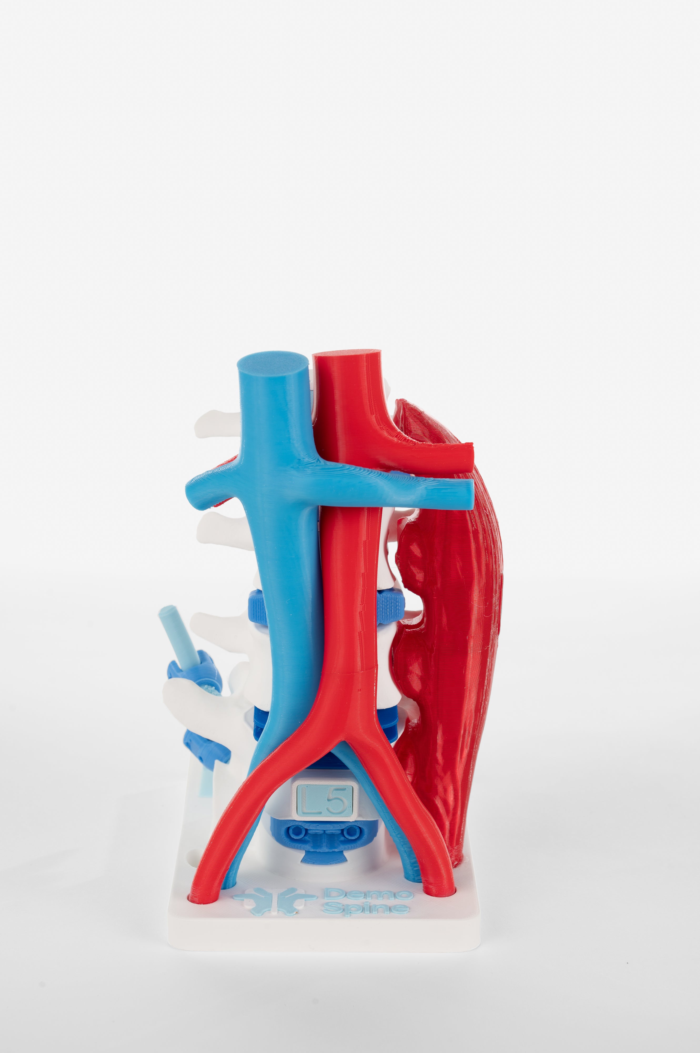 Anterior Lumbar Surgery Model