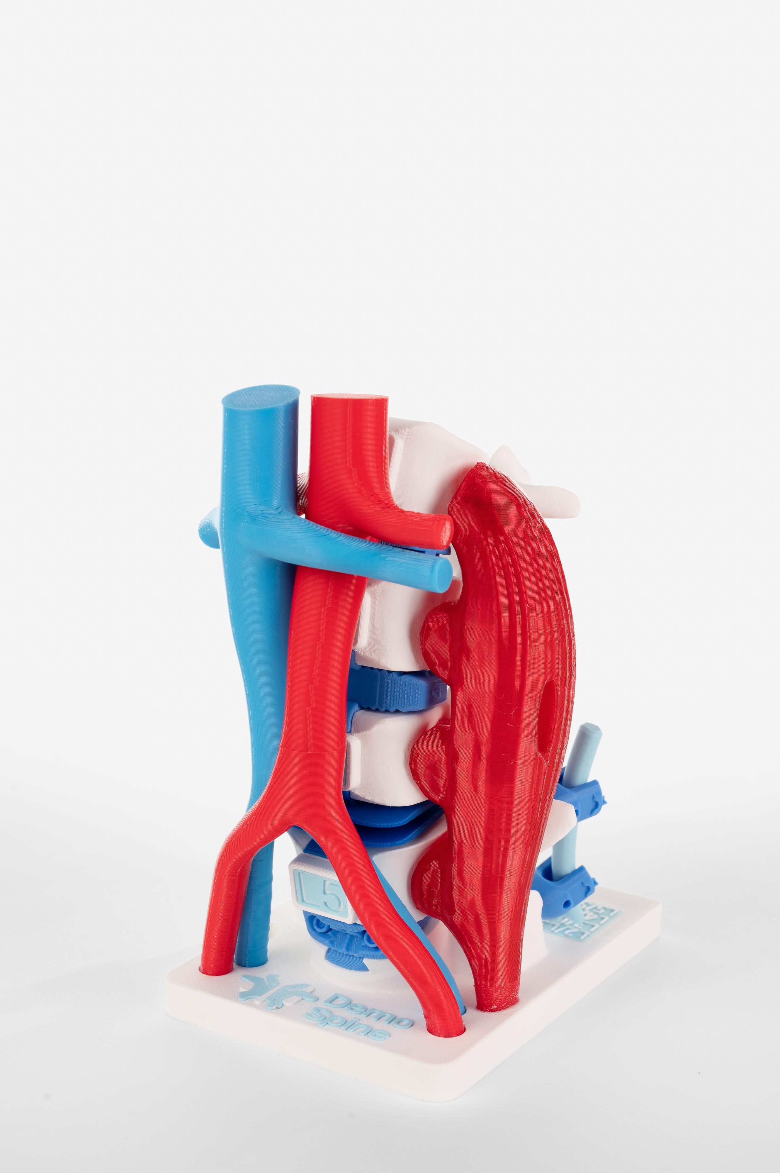 Anterior Lumbar Surgery Model