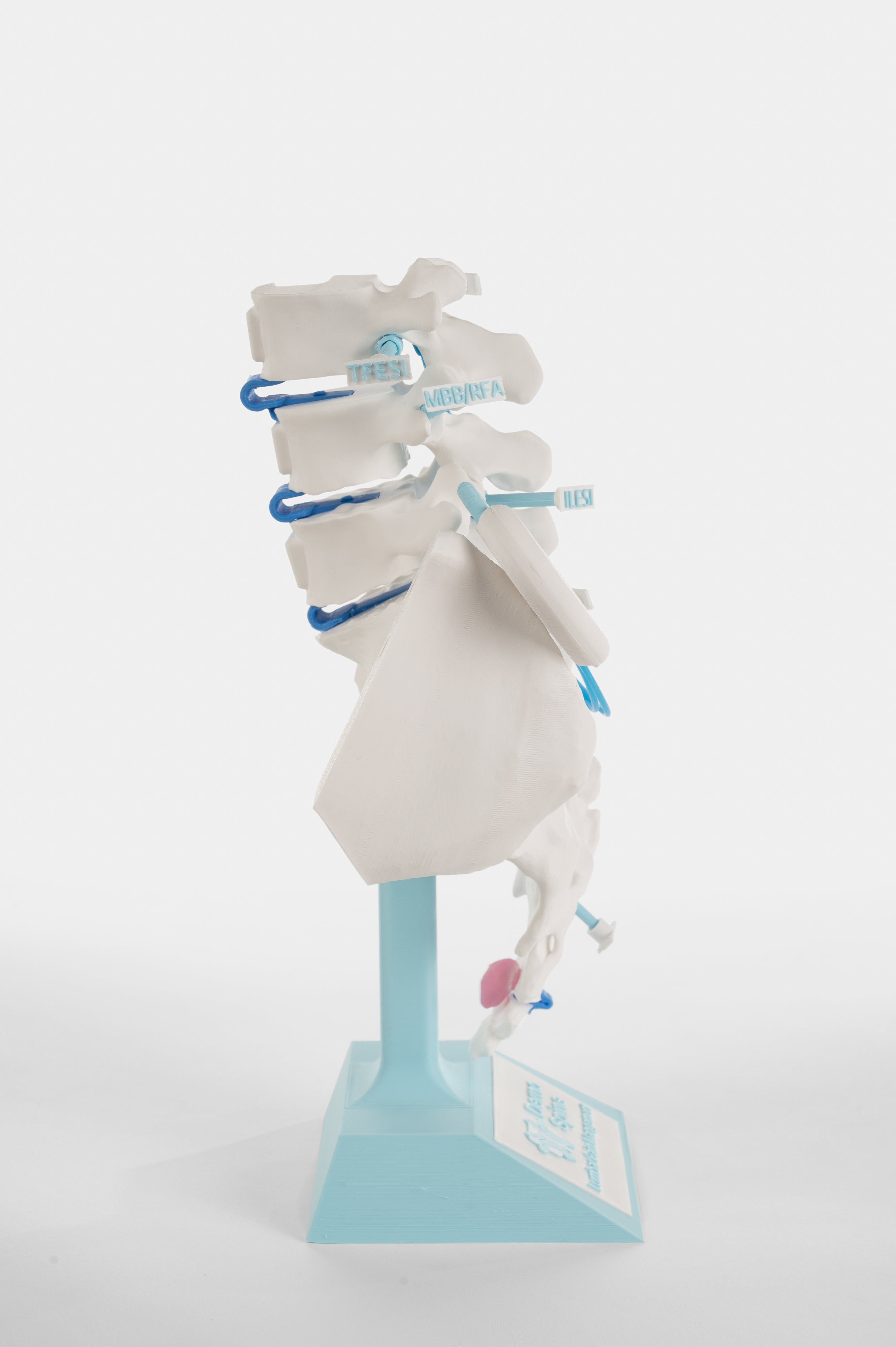 Lumbar Pain Model