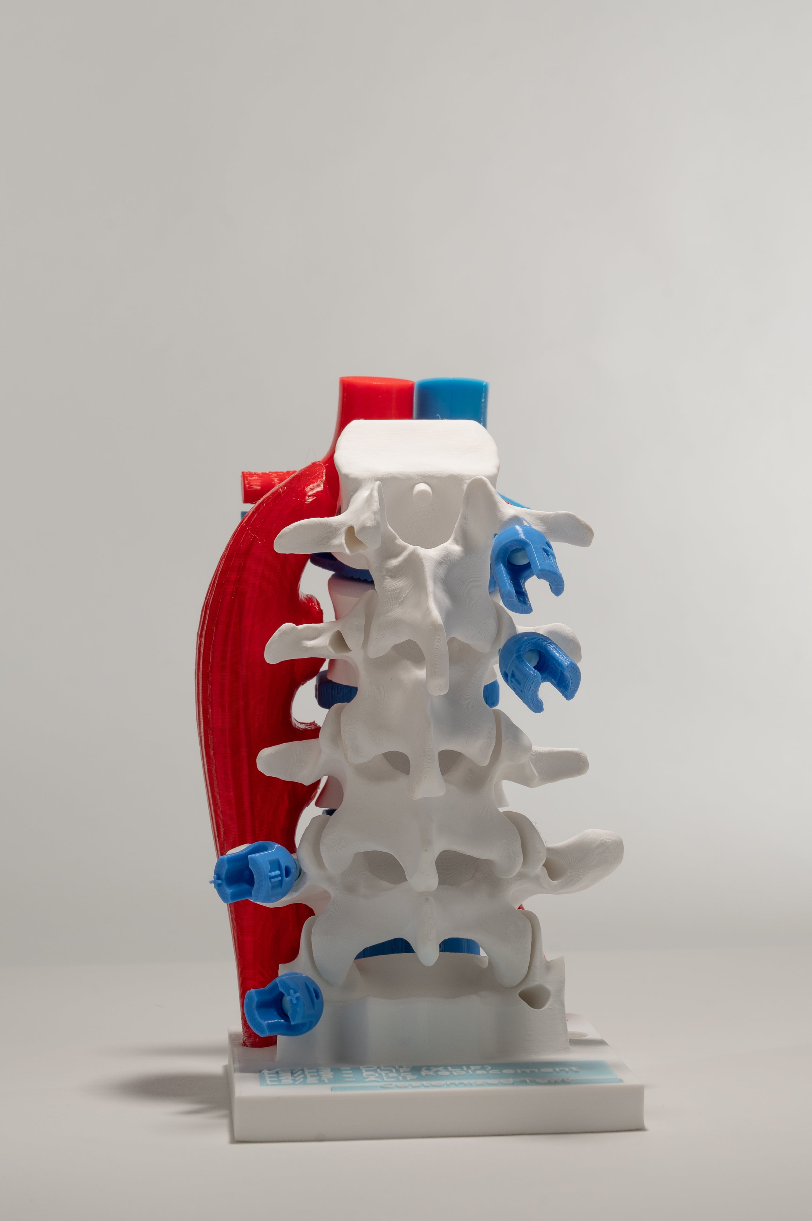 Anterior Lumbar Surgery Model